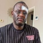 Congolese journalist Claude Pero Luwara was reportedly attacked by three masked men in Tienen, Belgium, on September 3, 2026. It is his third reported attack since August 2025.